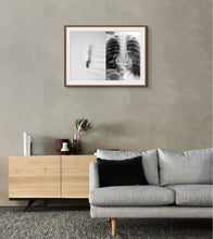 Load image into Gallery viewer, Chest Pain