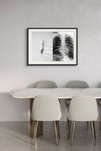 Load image into Gallery viewer, Chest Pain