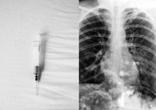 Load image into Gallery viewer, Chest Pain